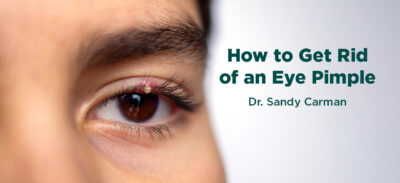 woman with pimple on eye with text "How to Get Rid of An Eye Pimple by Dr. Sandy Carman"